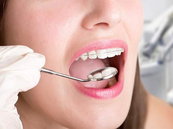 Как правильно выбрать ортодонта?