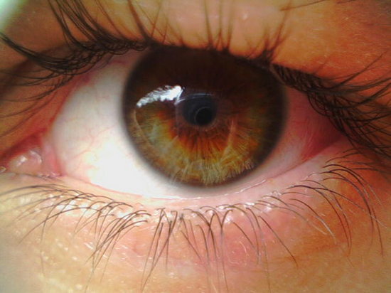 Лечение дистрофии сетчатки глаза