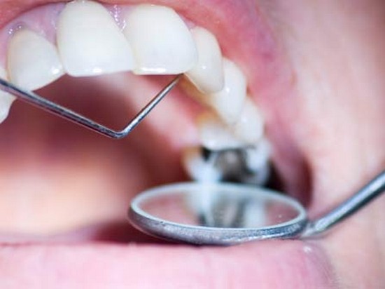 Больно ли лечить зубы?