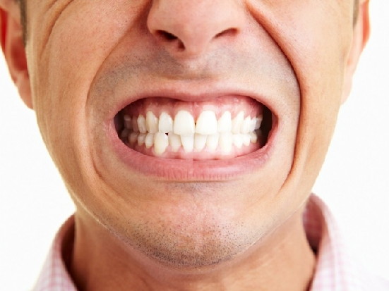 Как лечить бруксизм без помощи стоматологии