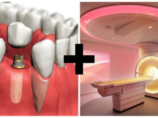Можно ли делать МРТ с имплантами зубов, коронками, брекетами?