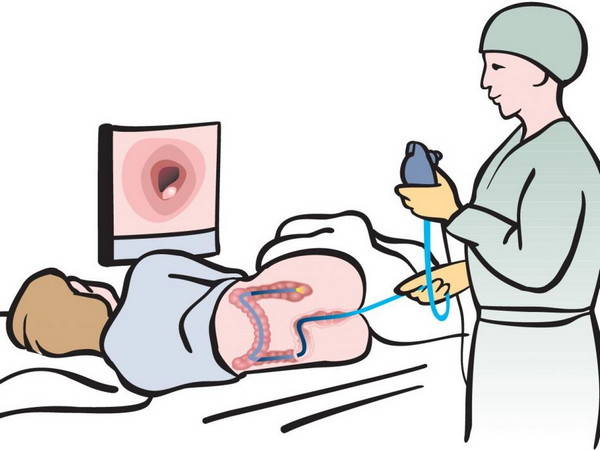 Колоноскопия кишечника: когда проводится, как именно и зачем