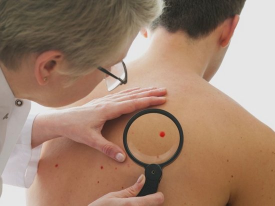 Почему появляются красные кровяные точки на теле?