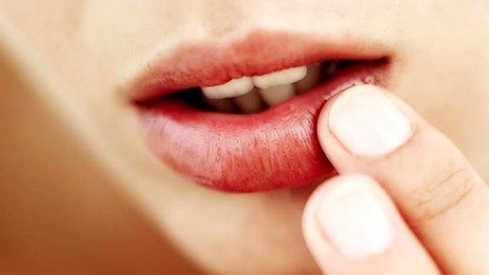 О чём говорят сухие раздраженные губы и как наконец-то избавиться