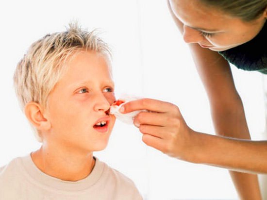 Почему у ребенка появляется кровотечение из носа?