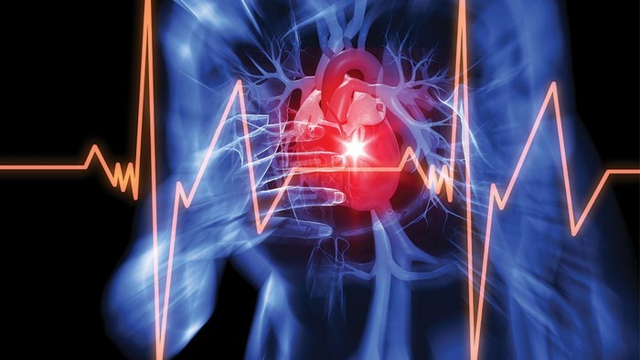 Что нужно знать об инфаркте – заболевании, которое в 45% случаев протекает бессимптомно