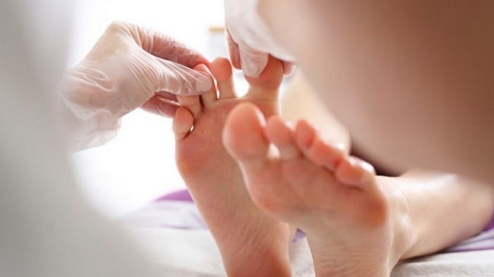7 методов вылечить вросший ноготь, не обращаясь к врачу