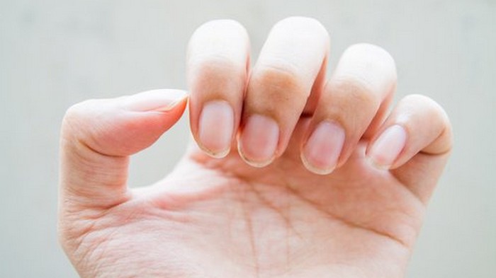 Как некрасиво: 9 способов отучиться грызть ногти