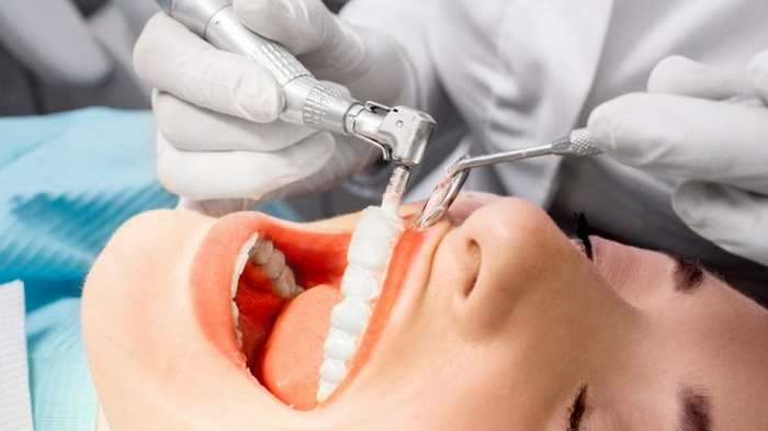 Комплексная чистка зубов у стоматолога: ключевые особенности и преимущества