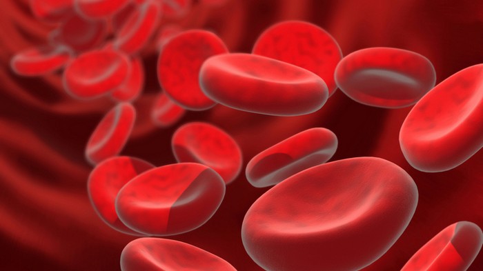 Железодефицитная анемия – причины, симптомы и лечение