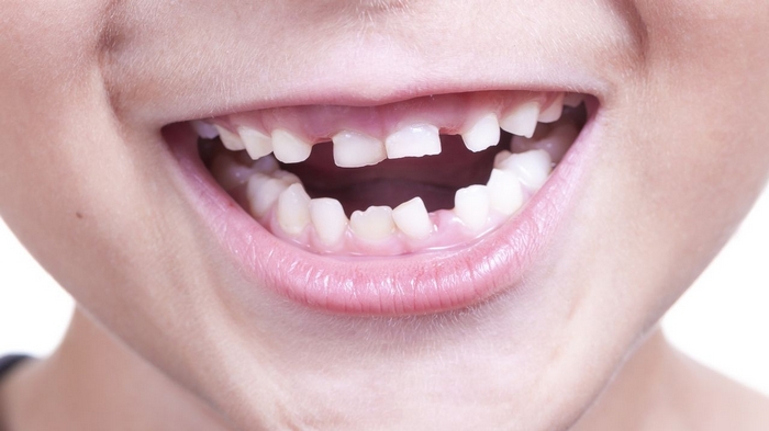 Когда выпадают молочные зубы?