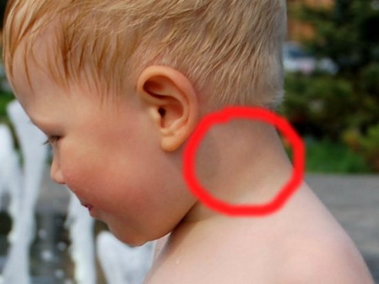 Увеличены лимфоузлы на шее у ребенка
