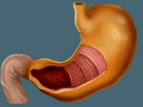 Симптомы повышенной кислотности желудка