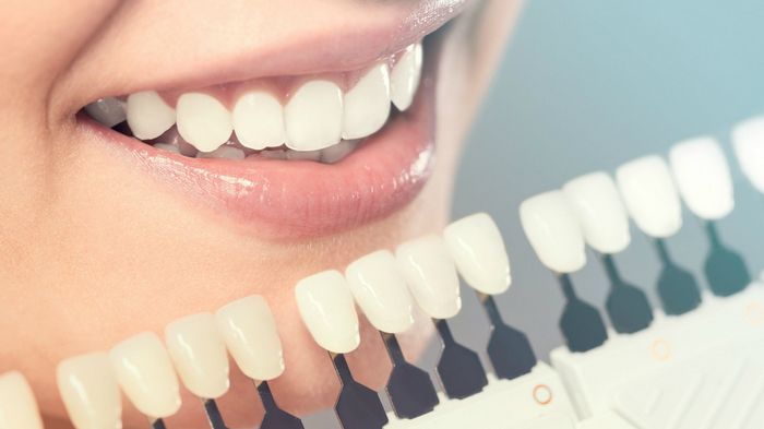Узнай, как легко удалить зубной камень и сделать улыбку белоснежной