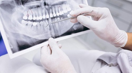 Как выбрать стоматологическую клинику для взрослых и детей?