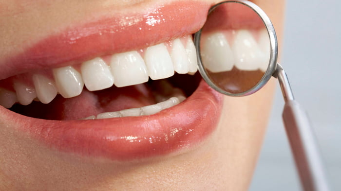 Отбеливание зубов в домашних условиях быстро и без вреда для эмали