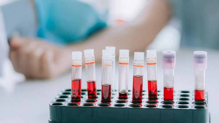 Расшифровка анализа крови, таблица: как понять, что указано в вашем анализе крови