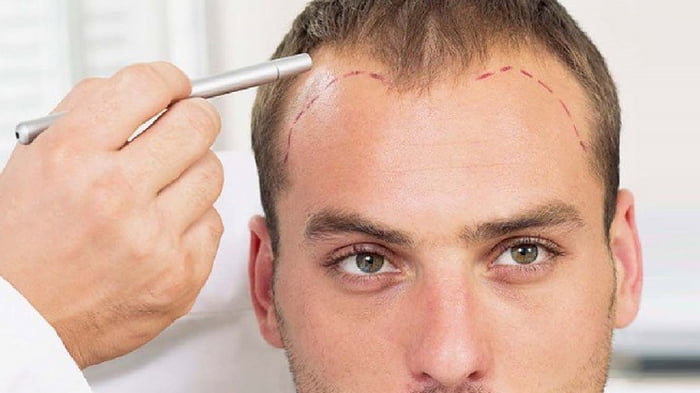Трихология: лечение выпадения волос и облысения