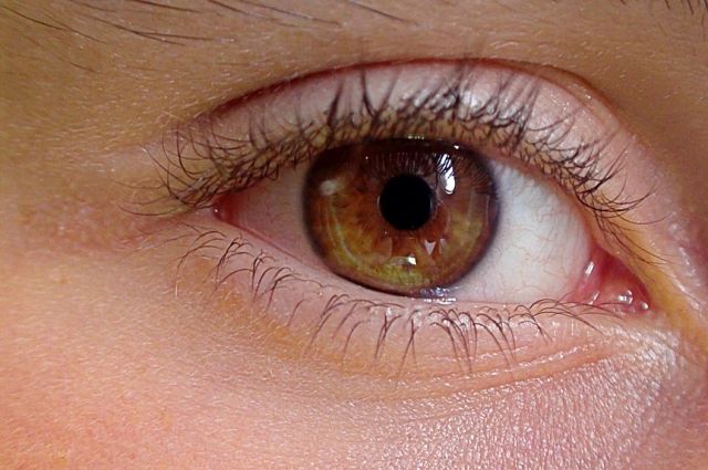 Ячмень на глазу, причины и лечение ячменя