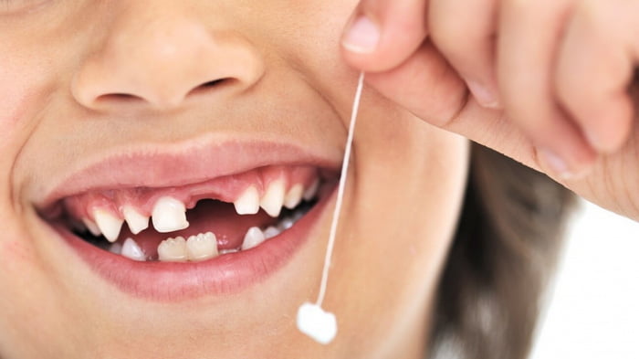 Молочные зубы – уход и профилактика кариеса