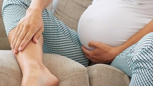 Отеки при беременности — что делать?