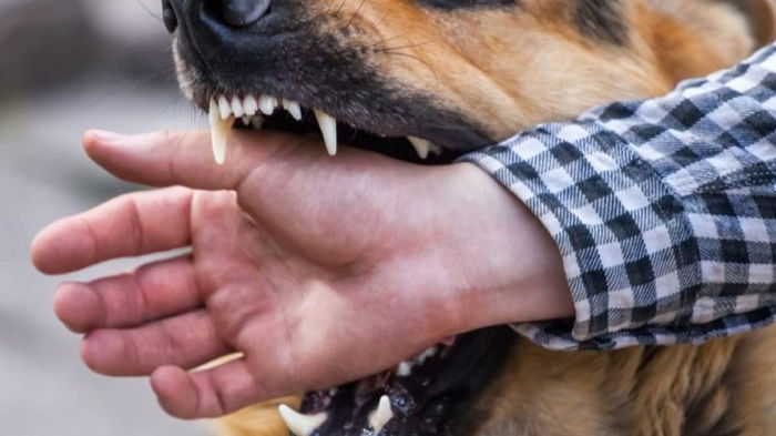Что делать в случае укуса собаки или дикого животного