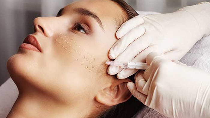 Биоревитализация – актуальный метод лечения кожных дефектов