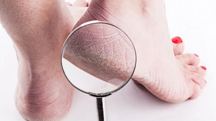8 домашних средств, которые решат проблему сухой кожи на ступнях