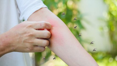 Три народных средства, которые быстро спасут от зуда после укуса комара