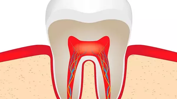 Пульпиты: виды и классификация
