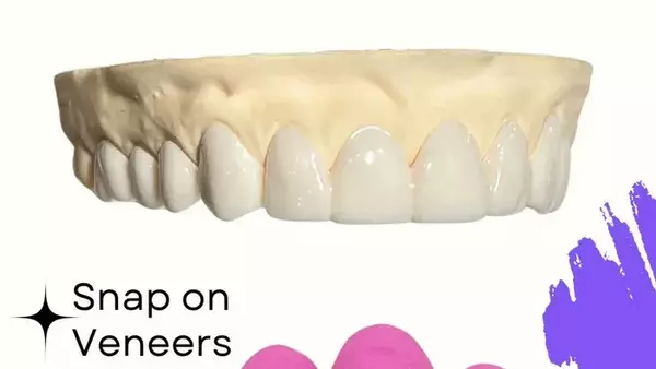 Улыбка без визита к стоматологу: зубные протезы и виниры от Smile Boutique NY