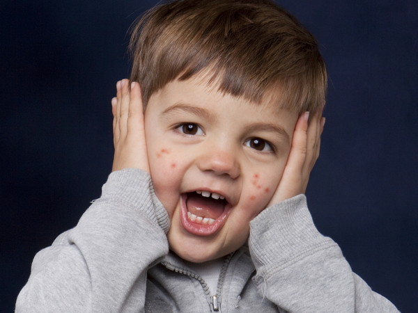 ​Сыпь на теле у ребенка: причины, лечение