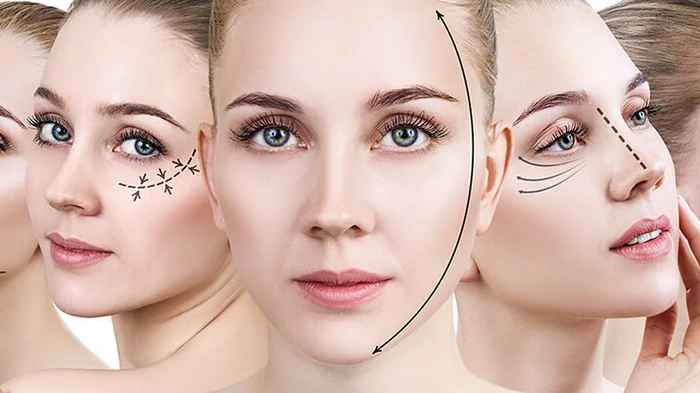 фейслифтинг лица