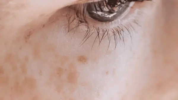 Избавьтесь от пигментных пятен и недостатков кожи по старинному индийскому рецепту