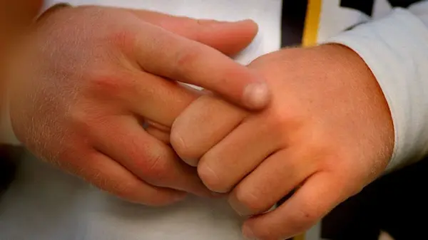 Действительно ли вредно хрустеть пальцами и будет ли артрит: ортопед ответил