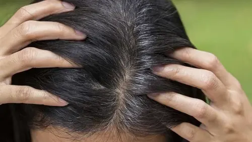 Надолго забудете о проблеме: как замаскировать седые волосы без исполь...