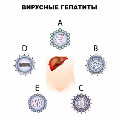 Вирусные гепатиты