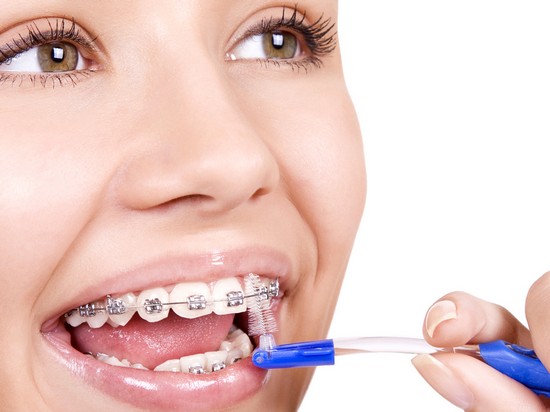 Как правильно ухаживать за зубами