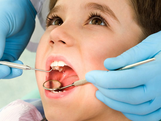 Проблемы с зубами: герметизация фиссур у детей
